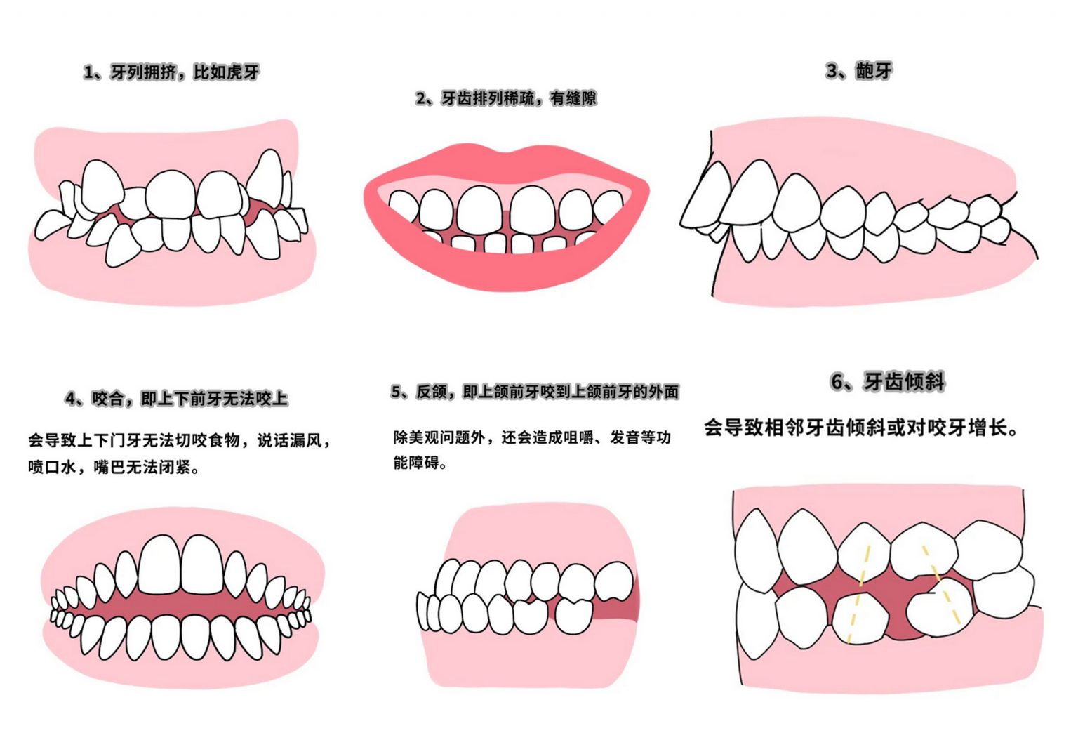 迷死氧兼职看牙 | 杨天宝的整牙论，大概是长了12对智齿吧 - 知乎